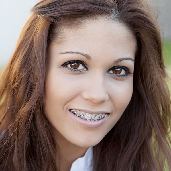 A young woman with braces smiling