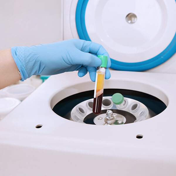 Centrifuge for processing the platelets